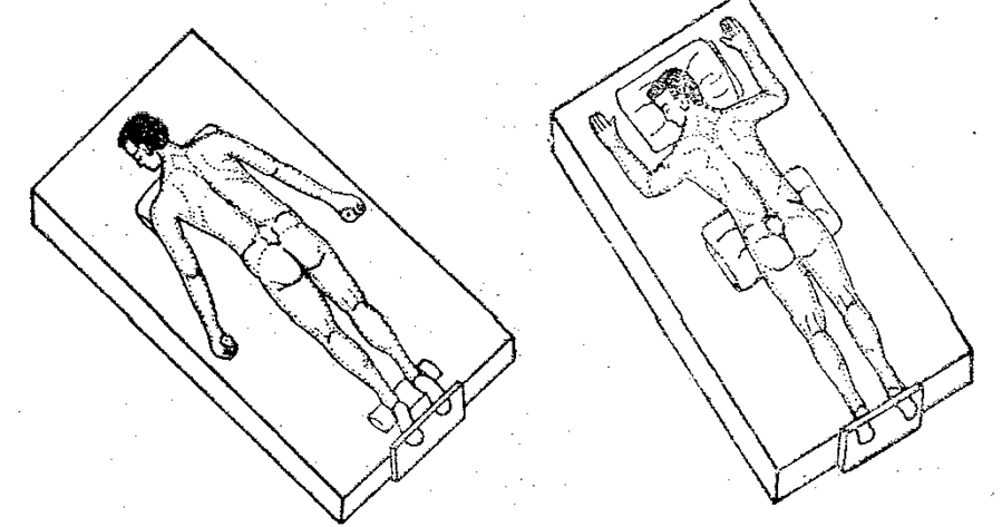 Decubit-VENTRAL